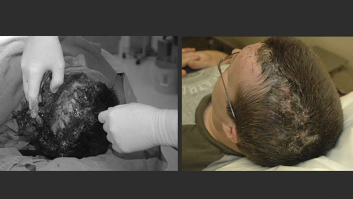 Client before and after reconstructive surgery.
